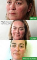 /album/photo-gallery-home/product-facial-cleanser-person2-jpg1/